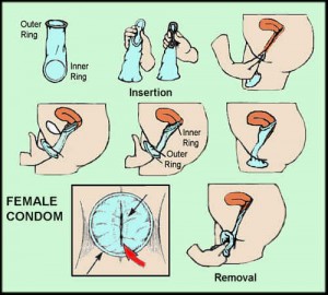 female condom